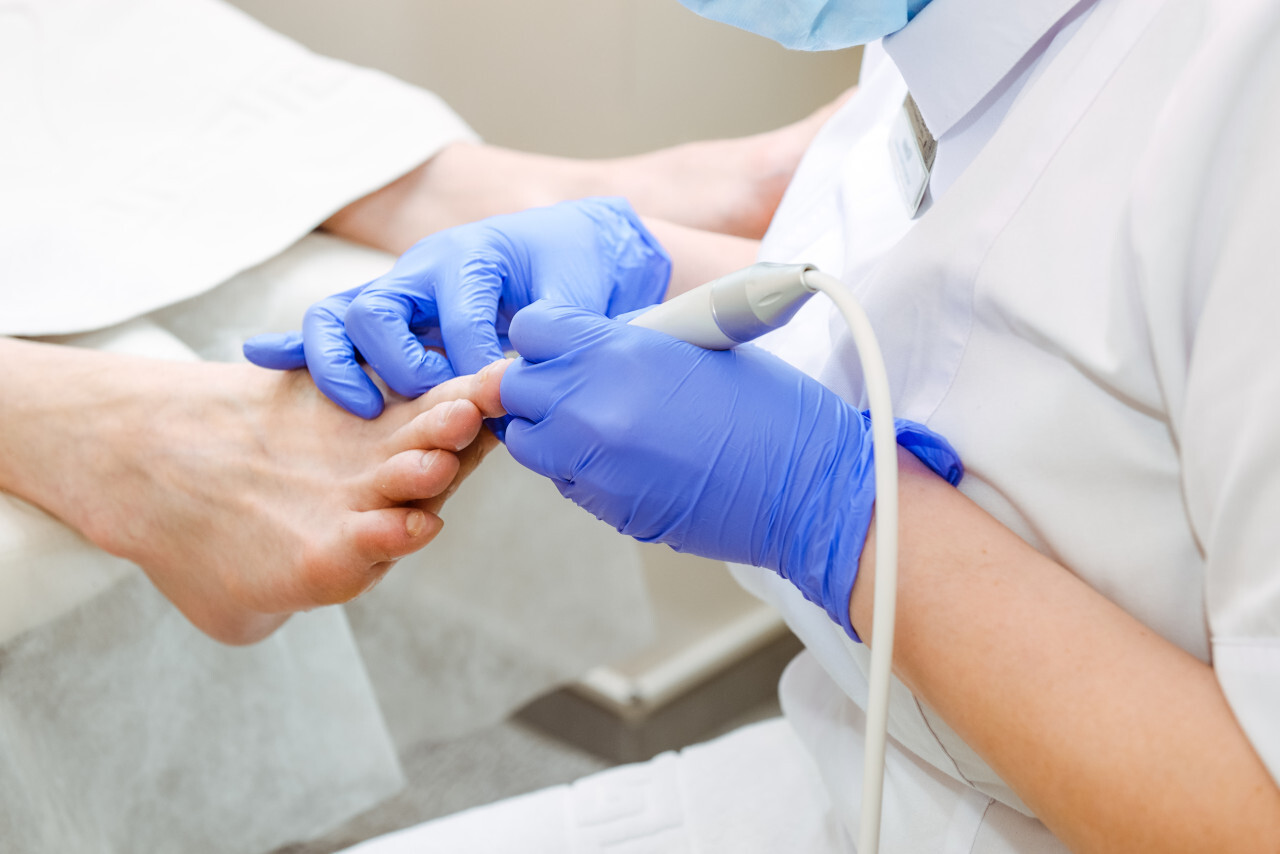 Pédicure médicale des orteils