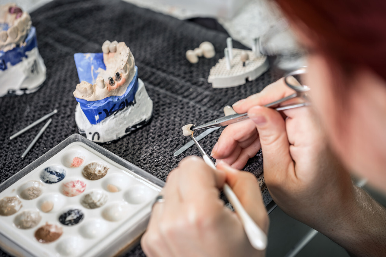 Implants dentaires fabriqués avec soin